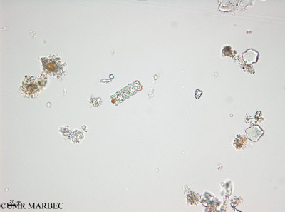 phyto/Thau_Lagoon/THAU_station1/OSU_plancton 2013/Paralia marina (Centrique8 -40x -140219 -2)(copy)_thumb.jpg